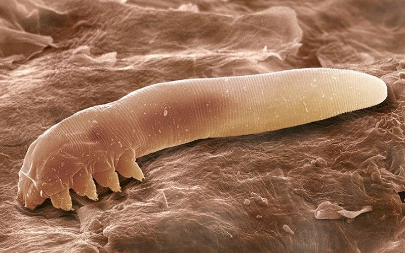 Organismo Que Vive En La Madera Así es como los ácaros viven en la piel y se reproducen en ella